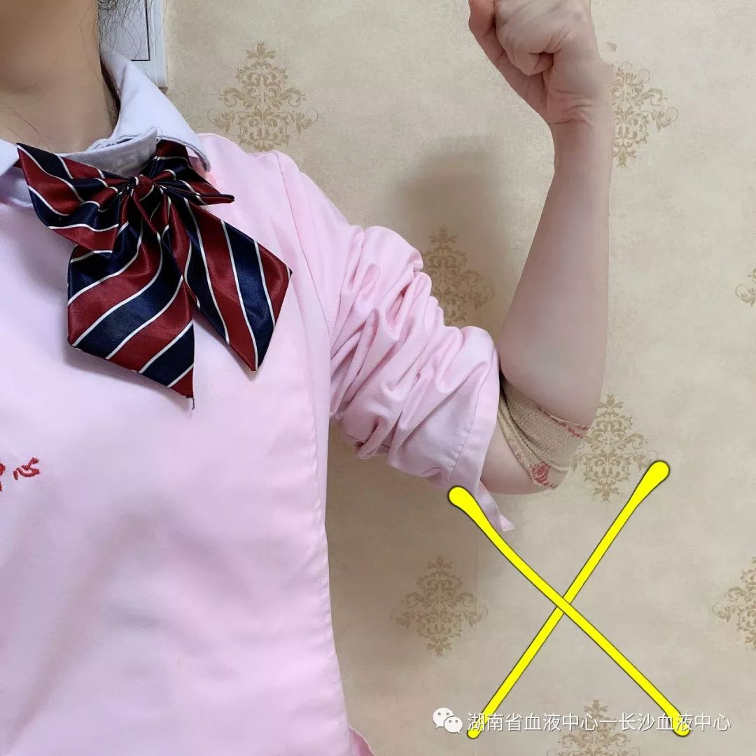 献血后手变“黑”了？Why?