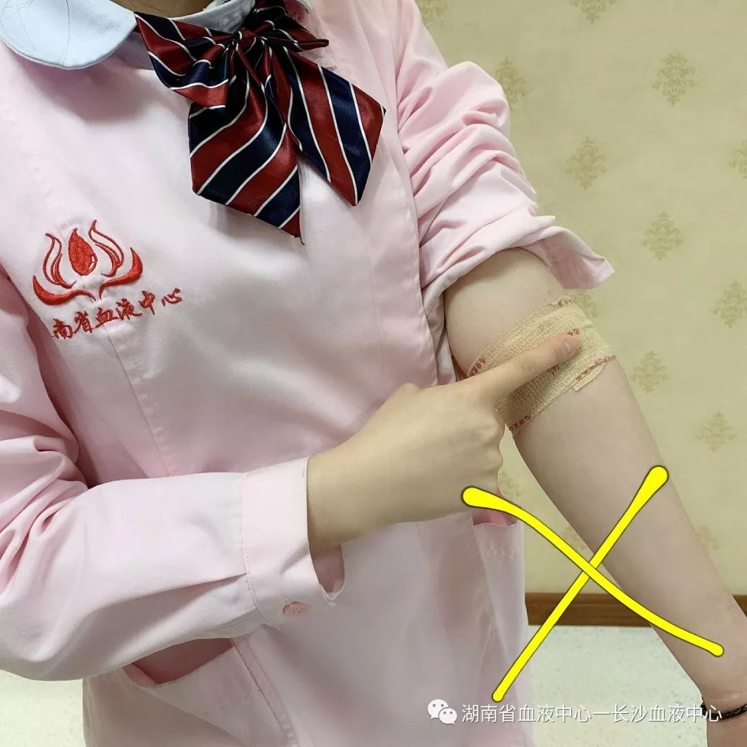 献血后手变“黑”了？Why?