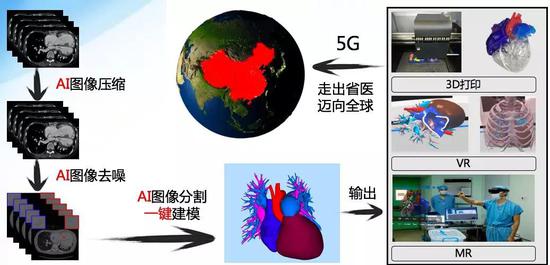 中国完成首例AI+5G心脏手术！
