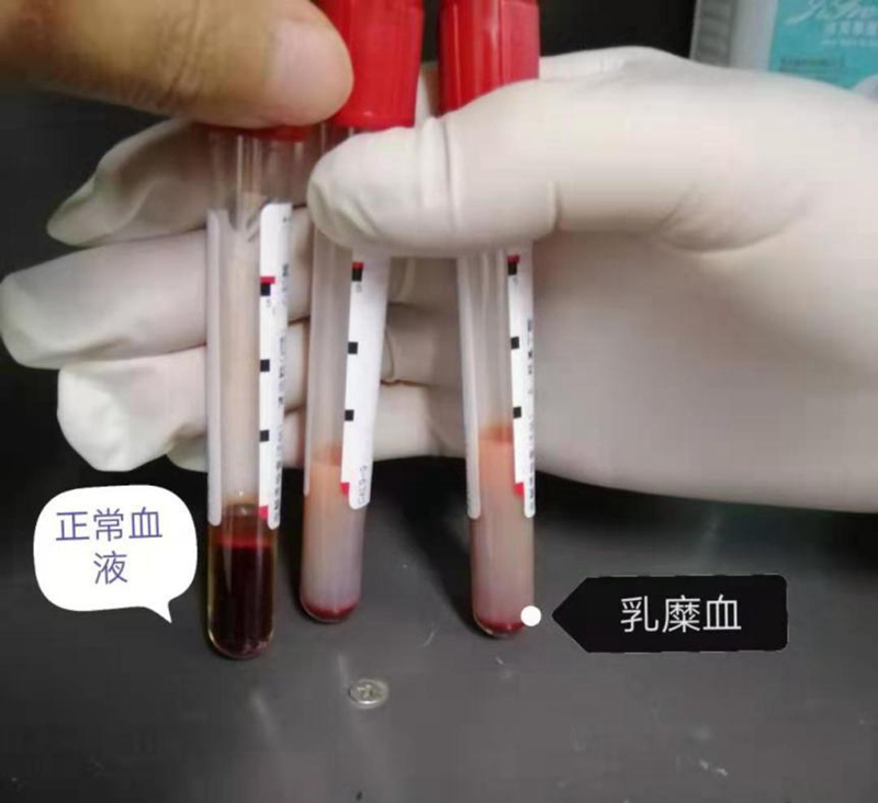好好的血液,怎么就变成了白色呢
