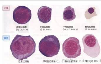 血液知识：【临床】识别血细胞的方法和要点