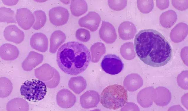 血液知识：【临床】识别血细胞的方法和要点