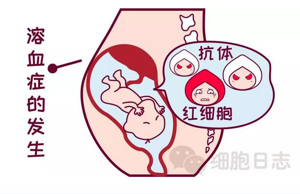 稀有血型之Rh型血,流淌在生命的边缘