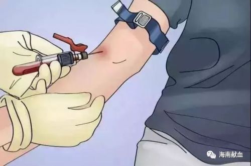 扎手指、抽手臂,原来采血也有大学问!