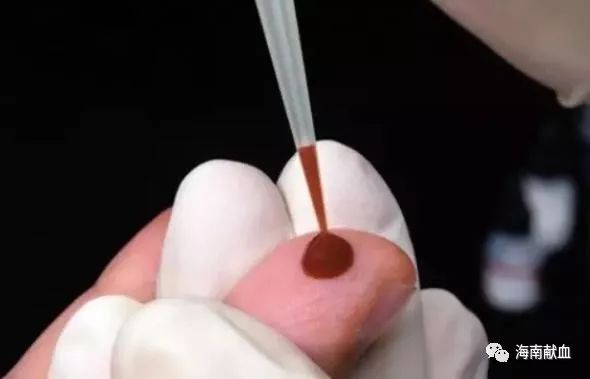 扎手指、抽手臂,原来采血也有大学问!