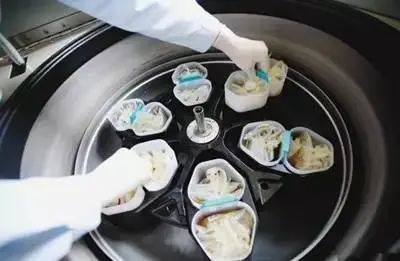 我到底是捐献200毫升还是400毫升呢？