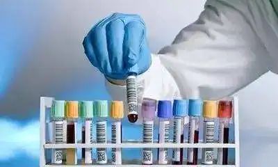 【科普】输血并非越多越好