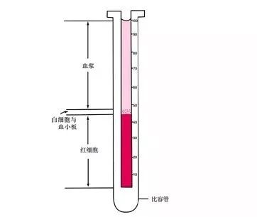 为什么适合献全血的人还不一定适合献血小板？